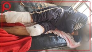 कुख्यात वांछित अपराधी शांतनु कुमार हुआ घायल।