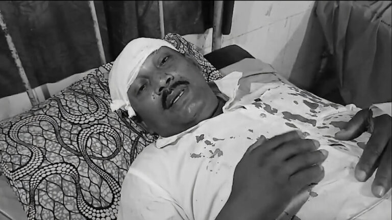 बंगाल में बूथ के बाहर बिछ गया खून: भाजपा पोलिंग एजेंट पर जानलेवा हमला, डरे मतदाता नदिया में भाजपा पोलिंग एजेंट हमला