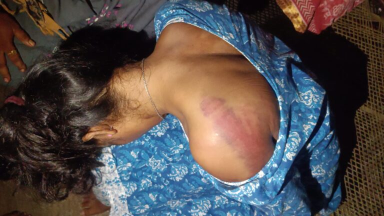 आदिवासी युवती ने पुलिस पर लगाए गंभीर आरोप, कपाली मामले की निष्पक्ष जांच की मांग तेज
