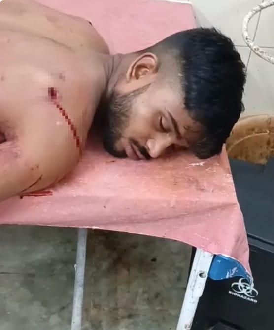 आदित्यपुर में युवक पर धारदार हथियार से हमला, आरोपी पिंटू प्रधान हिरासत में